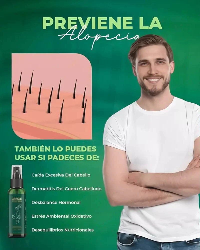 🌿Tónico Capilar OUHOE - 100% Natural para Crecer, Fortalecer y Recuperar Confianza 🌿