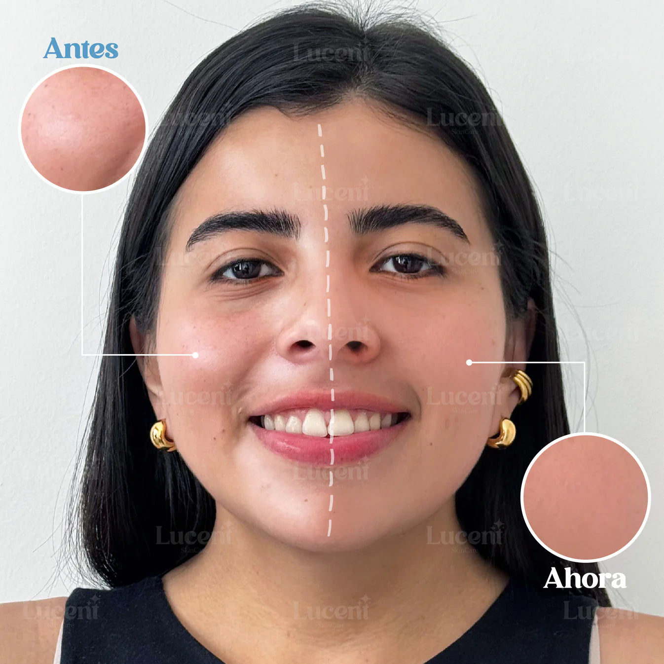 CANDY BELLA® 🌀 | GEL PENSADO PARA CONTROL DE GRASA FACIAL