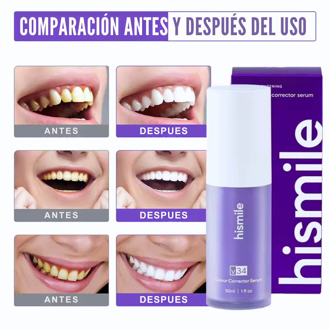 HISMILE® - “Dientes más claros ya” 💜